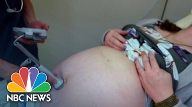 Nationwide, 36% Of Counties, Largely In The Midwest And South, Constitute 'Maternity Care Deserts'