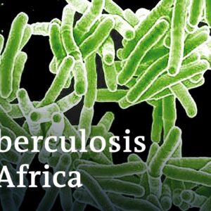 Can new vaccines stem Africa's rising tuberculosis numbers? | DW News