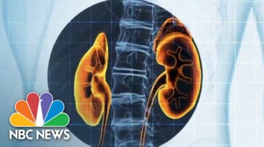 Black patients face historically longer waiting times for kidney transplants due to outdated test