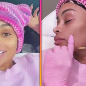 Blac Chyna Removes Her FACE FILLERS!