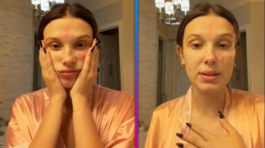 Millie Bobby Brown Gets REAL About Her Acne