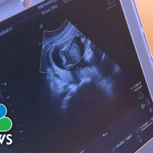 South Carolina GOP leaders say bill criminalizing abortion as homicide ‘won’t happen’