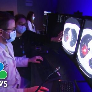 AI could revolutionize cancer detection, according to MIT, Mass General research