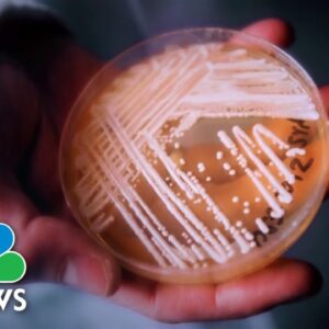 CDC warns dangerous fungus infection poses nationwide threat