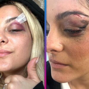 Bebe Rexha Fan Hit Singer With Phone, Thinking 'It Would Be Funny’
