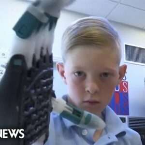 California eighth graders 3D print prosthetic hand for schoolmate