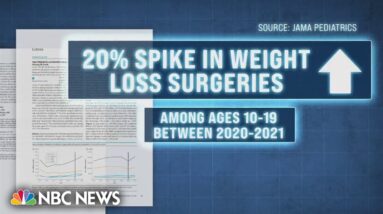 Weight loss surgeries spiking among children and young adults, study finds