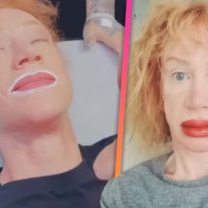 Kathy Griffin Shares SHOCKING Results of Getting Lips Tattooed