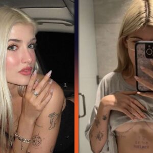 Sami Sheen Documents Breast Augmentation and Painful Recovery