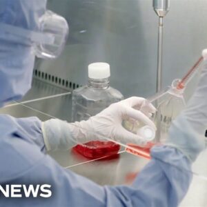 FDA approves groundbreaking sickle cell anemia treatment