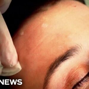 Federal regulators issue warning as med spas surge across U.S.