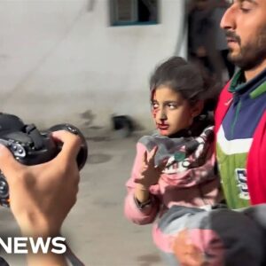 Wounded children treated in hospital after deadly Israeli strike in Rafah